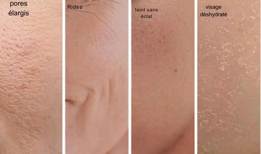 Bio-Collagen Deep Mask (set de 4)