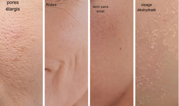 Bio-Collagen Deep Mask (set de 4)